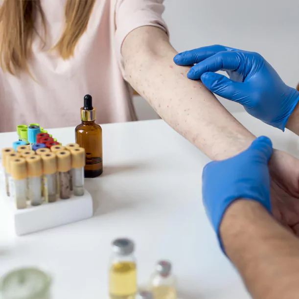 skin testing for allergy treatment